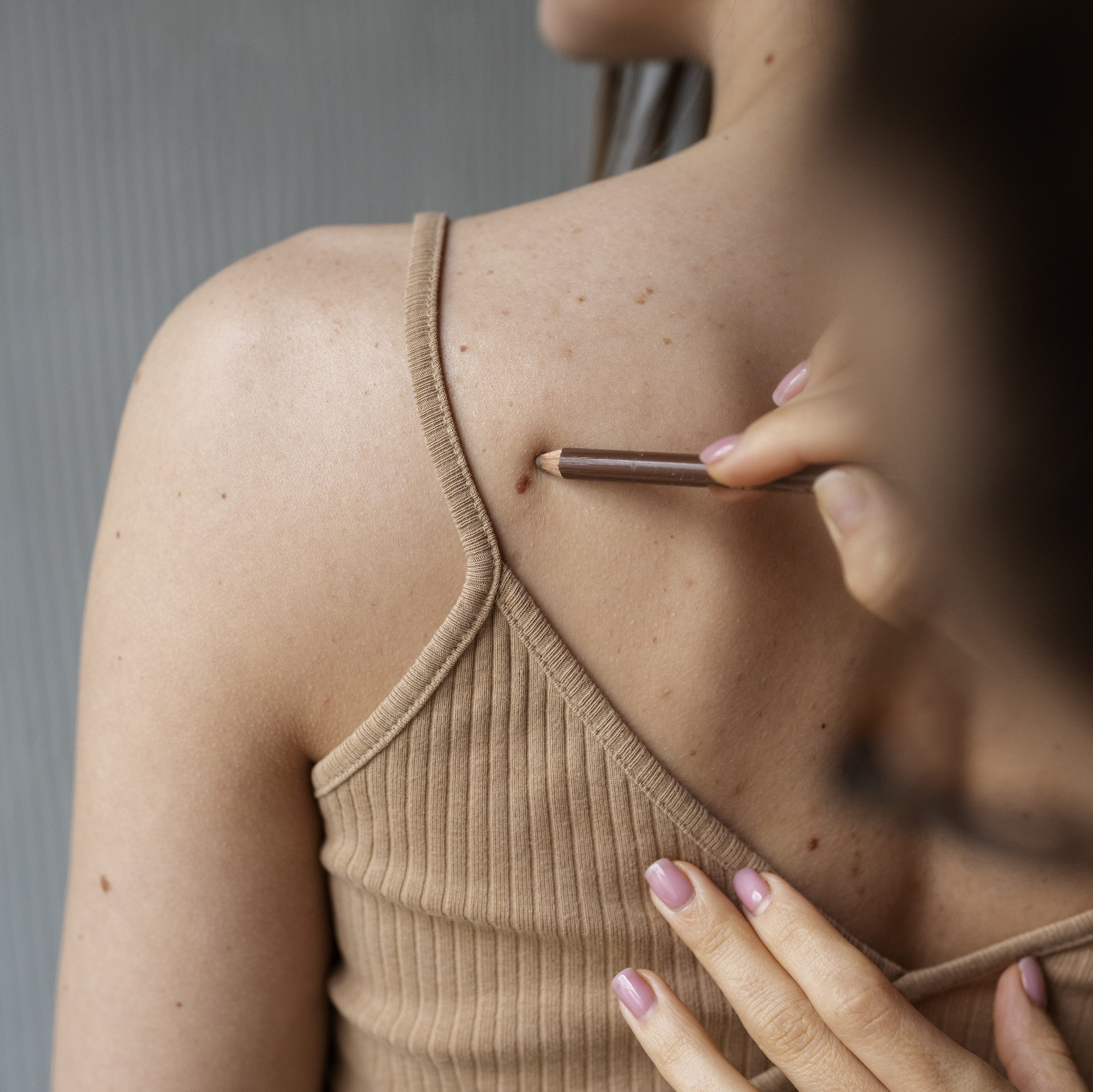 female-doctor-diagnosing-melanoma-body-female-patient (1)